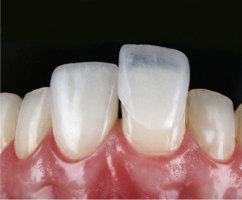 Ortodontia  Odontologia Dra. Msc. Luciana da Silva